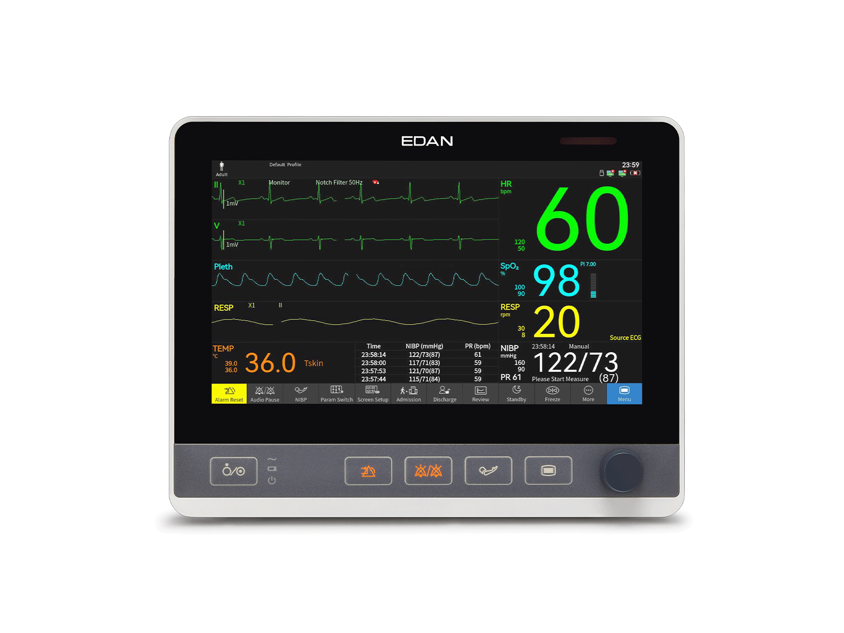 Monitor cX