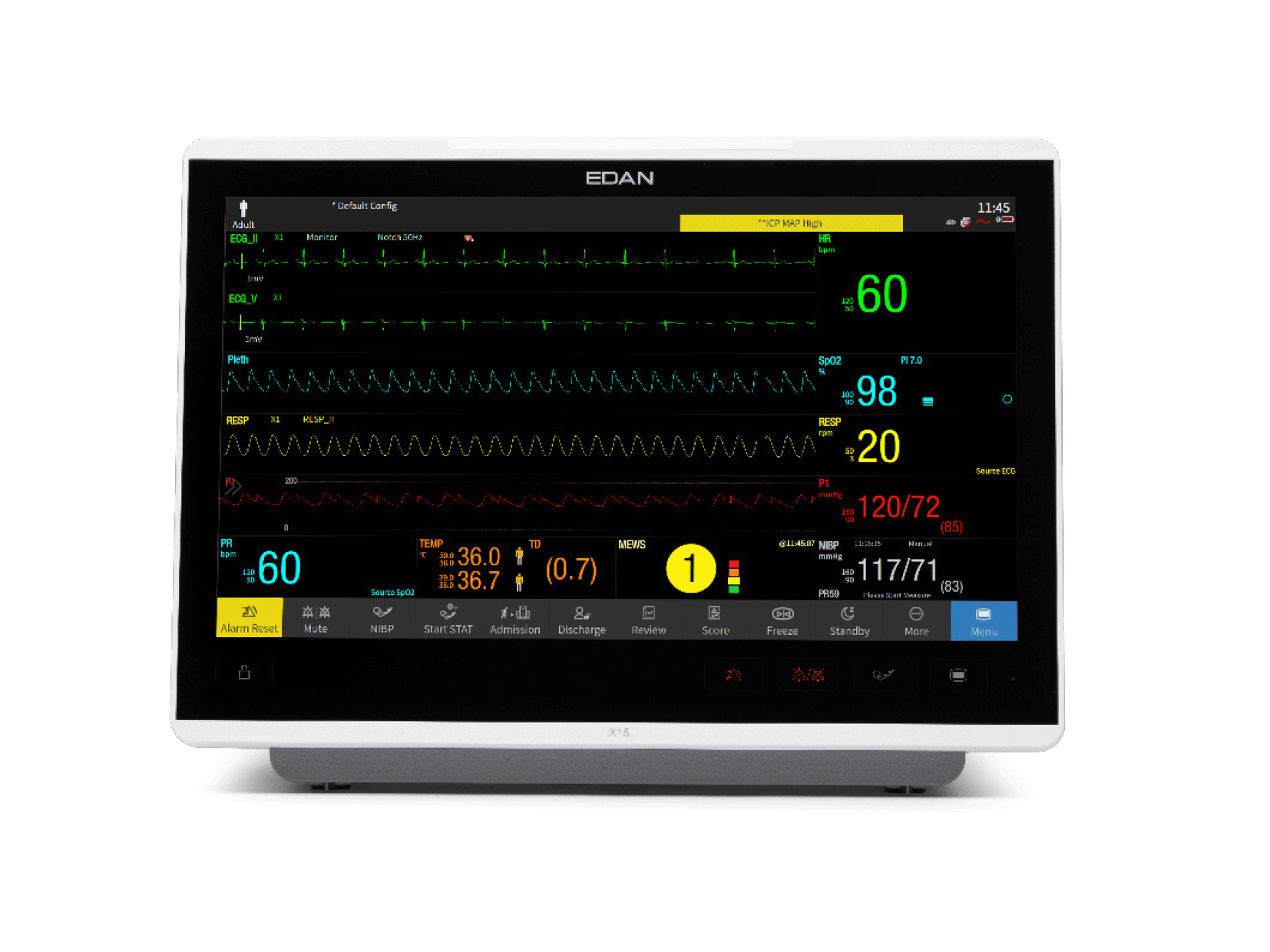 Monitor iV
