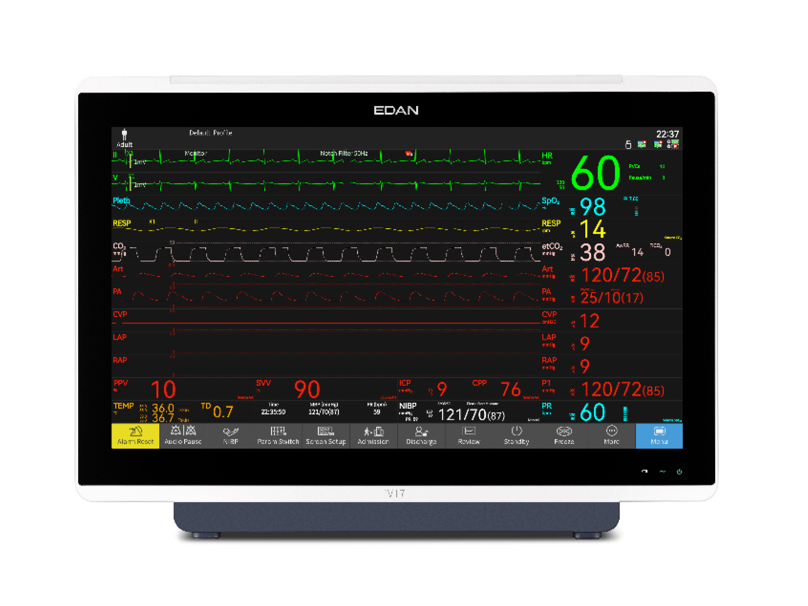 Monitor iV
