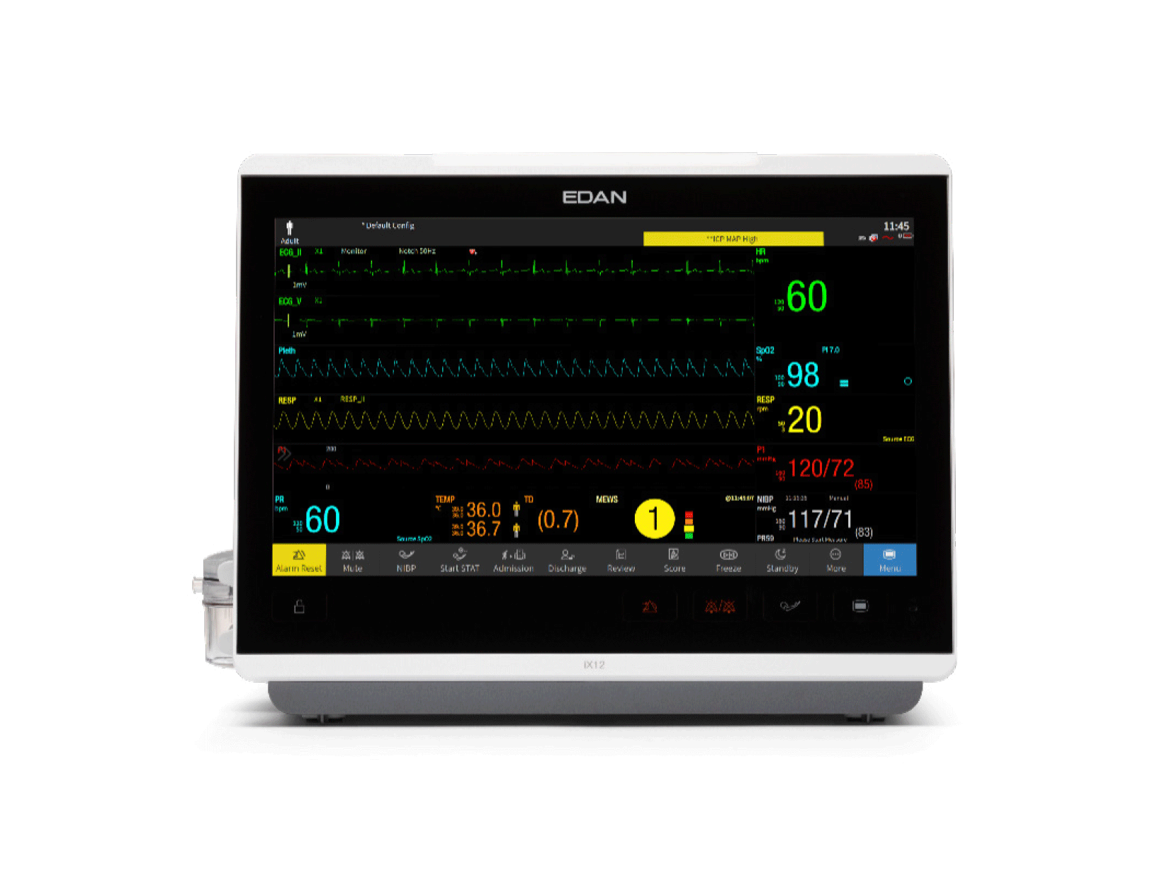 Monitor iV