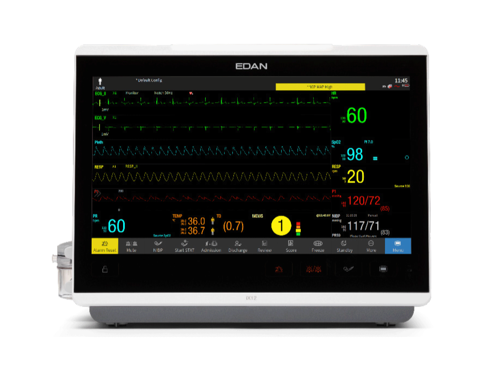 Monitor cX
