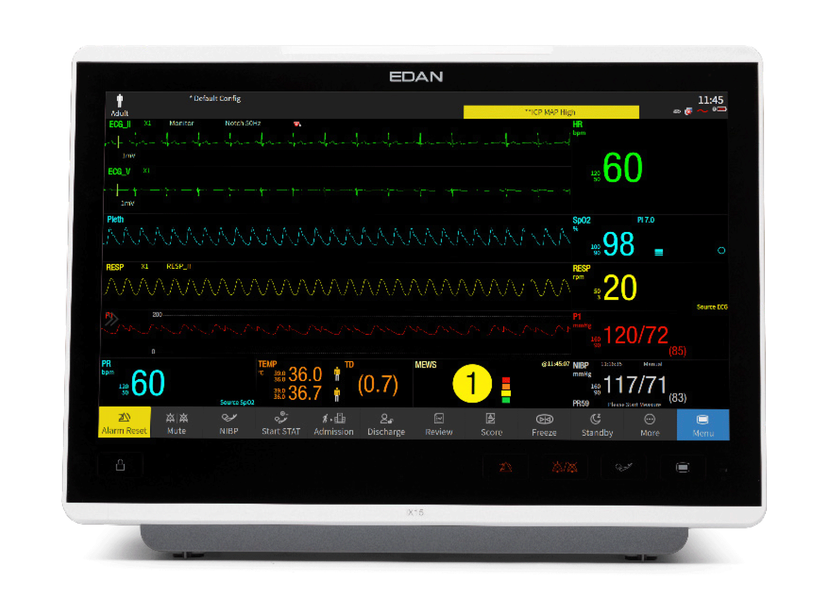 Monitor cX