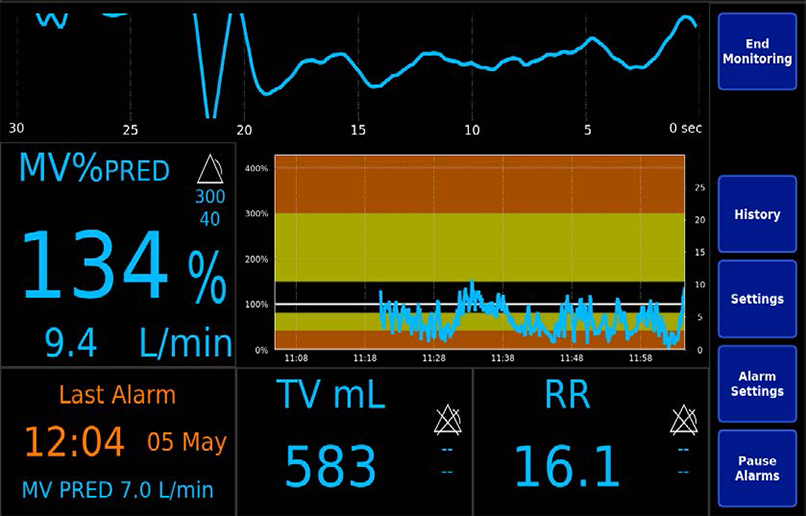 Monitor ExSpiron