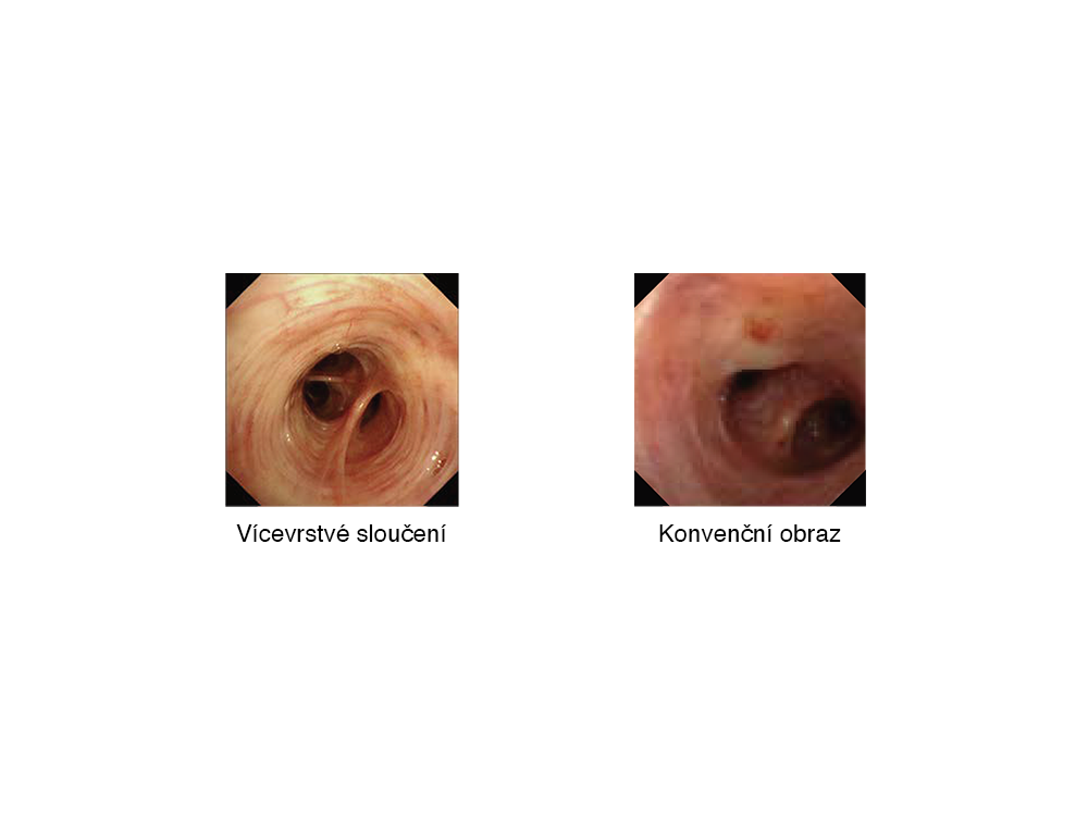 Automaticke nastaveni jasu