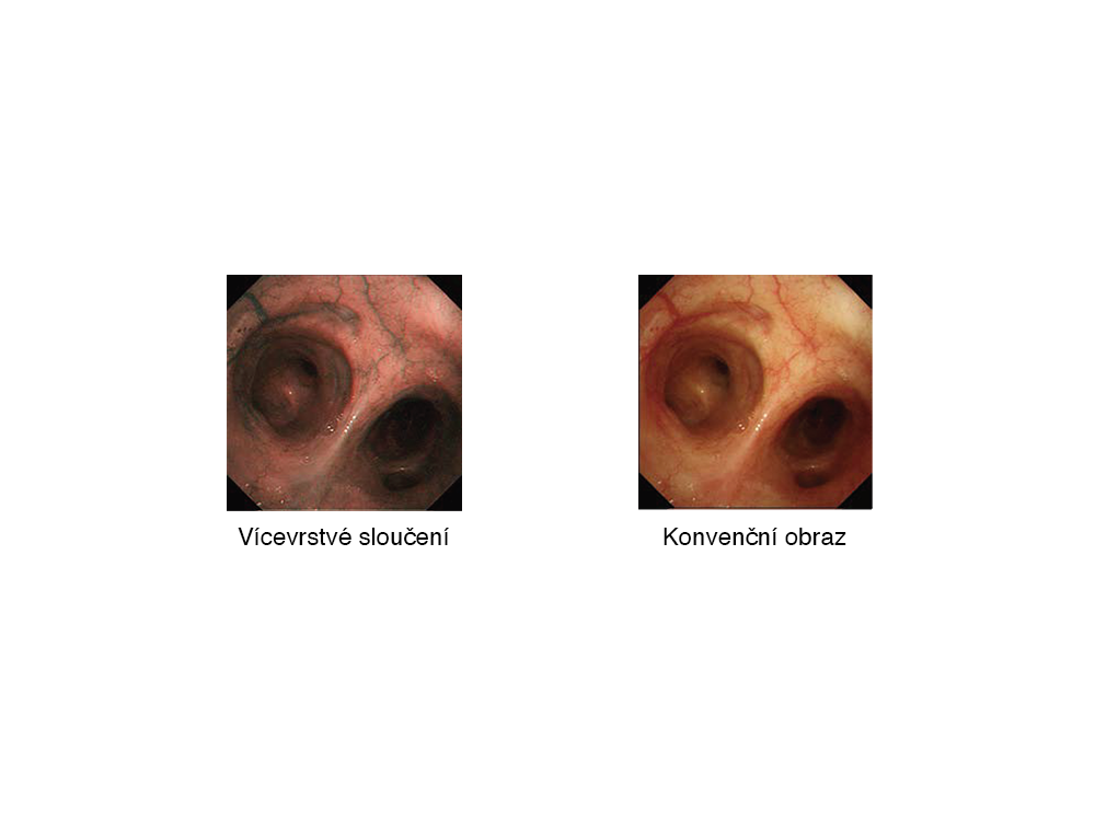 Zlepseni zobrazeni cev