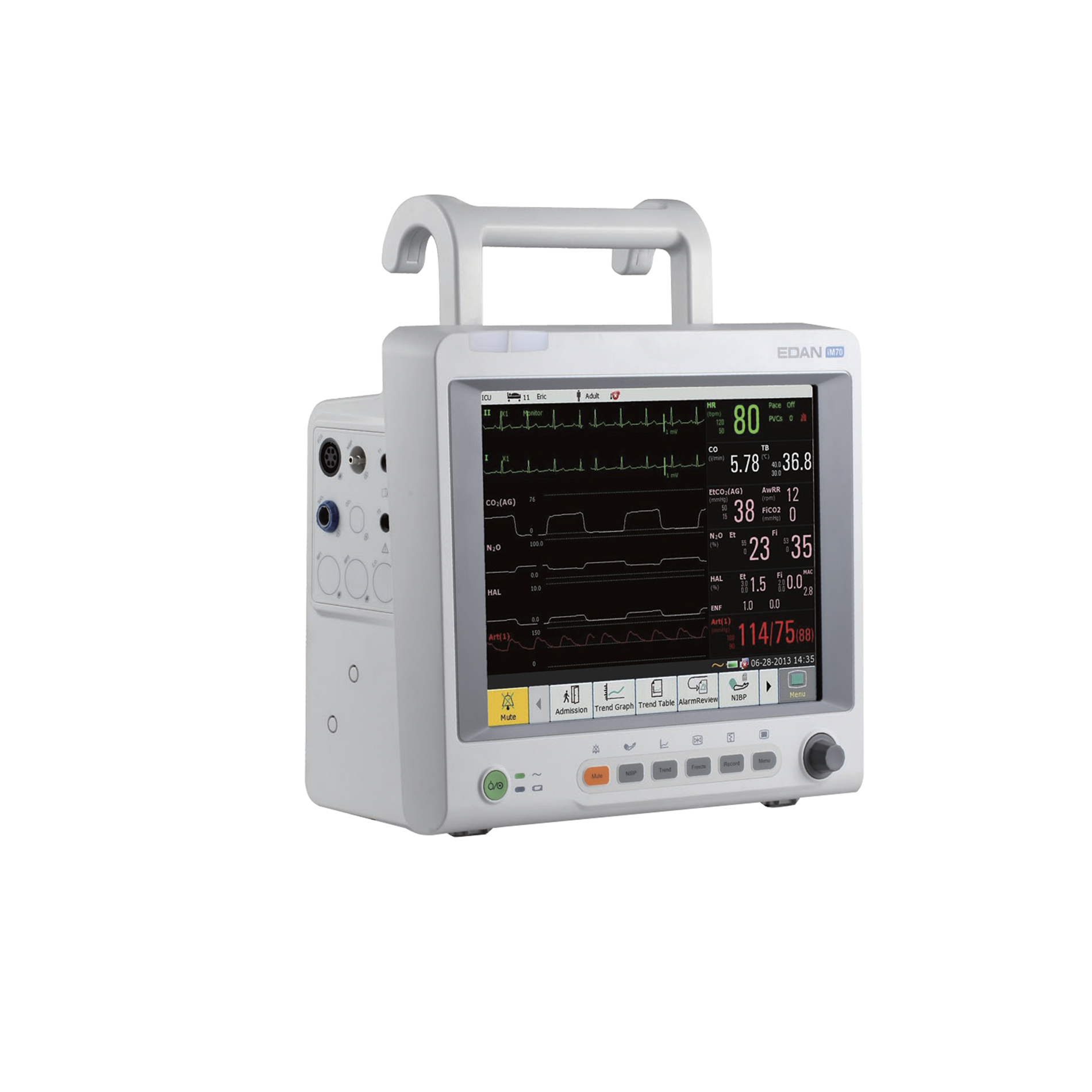 Monitor iM70 (SpO2 Edan)