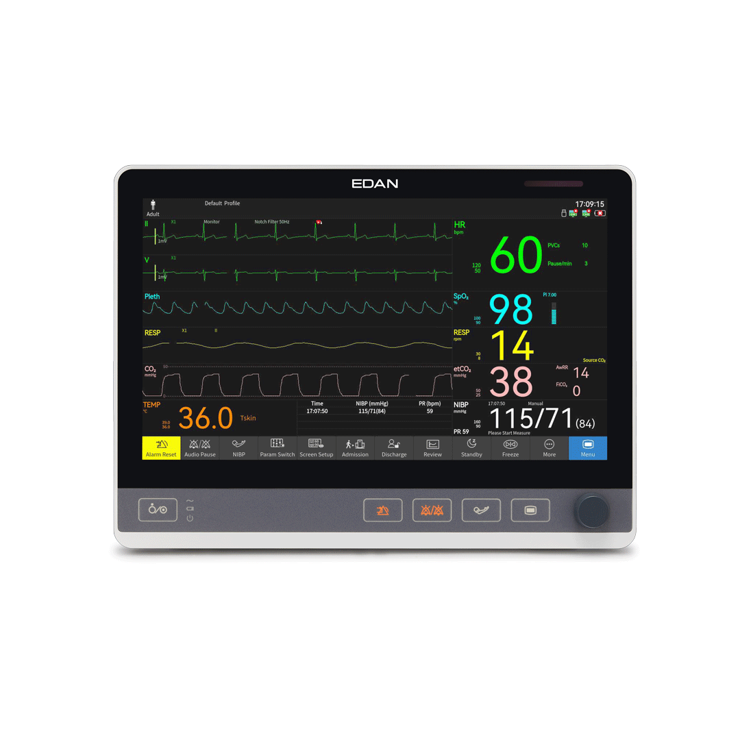 Monitor CX12, DO