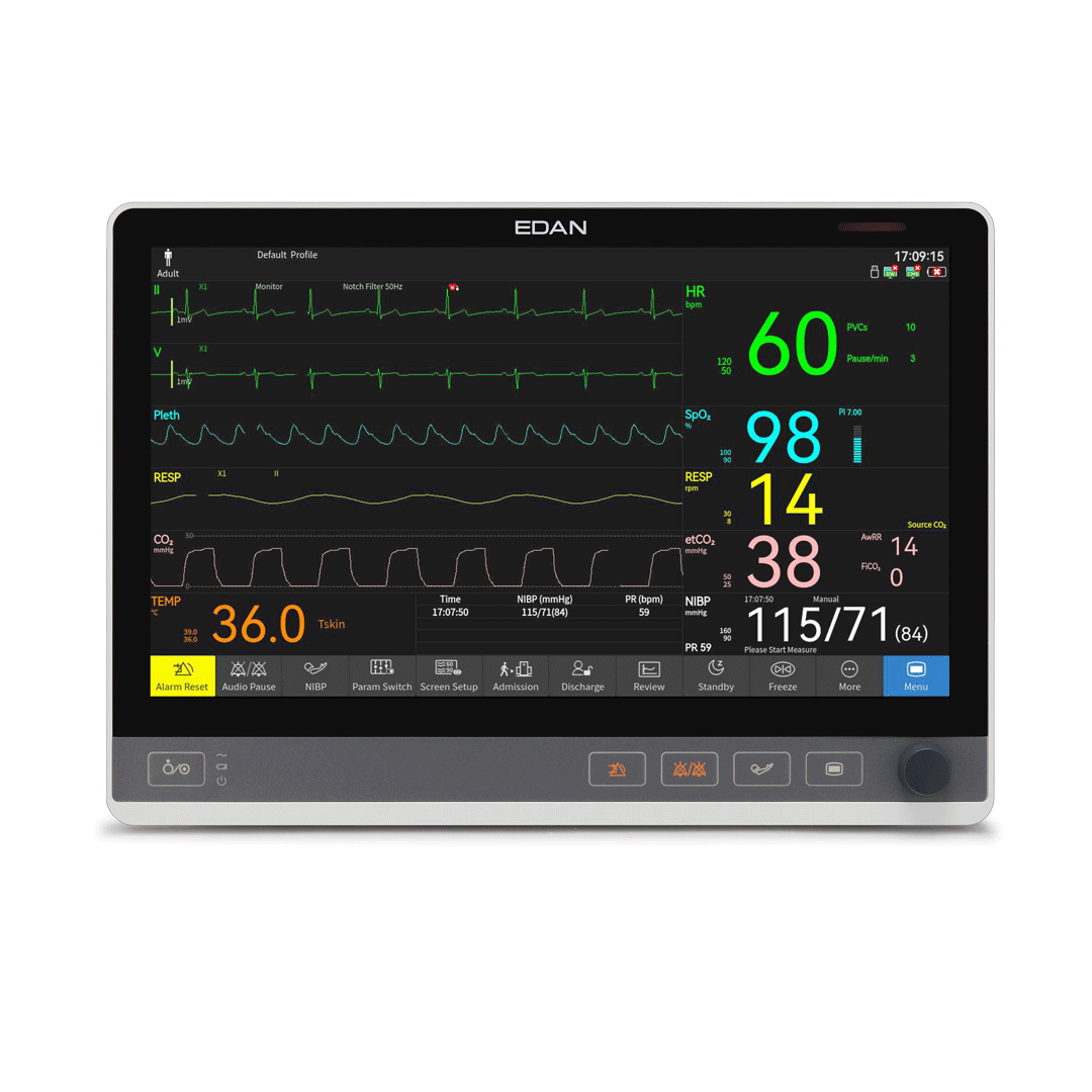 Monitor CX15, DO