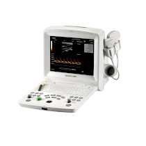Ultrazvuk digitální DUS 60
